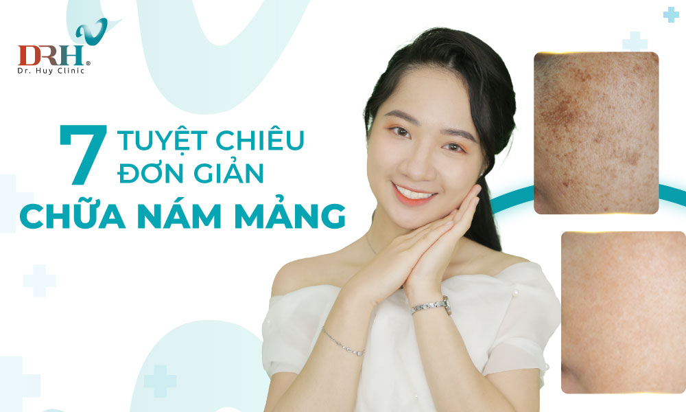 dieu-tri-nam-mang