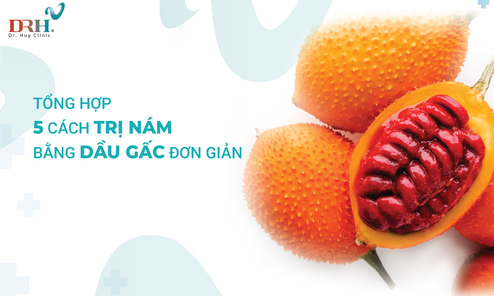 5-cach-tri-nam-bang-dau-gac