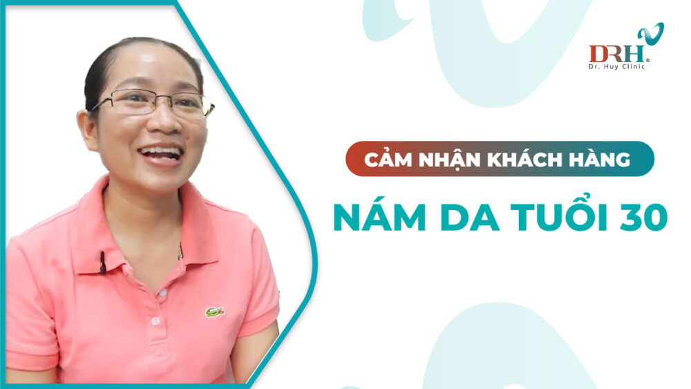 cam-nhan-benh-nhan-nam-da-tuoi-30