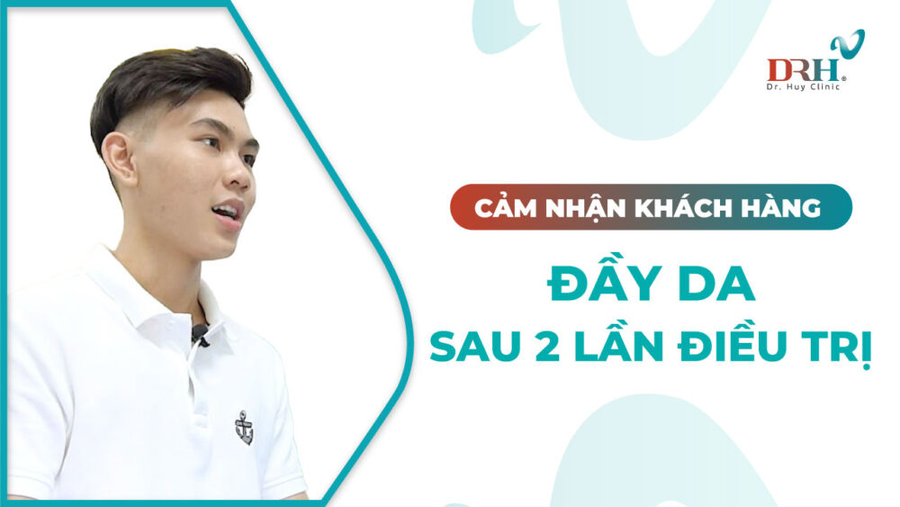 cam-nhan-day-ro-sau-2-lan-mezo