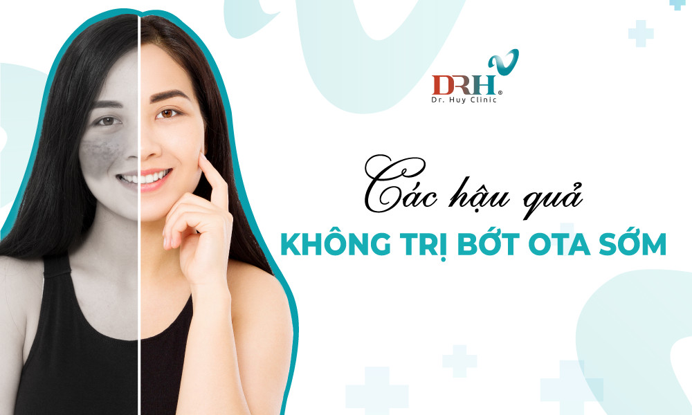 Cac-hau-qua-neu-khong-dieu-tri-biet-Ota-som