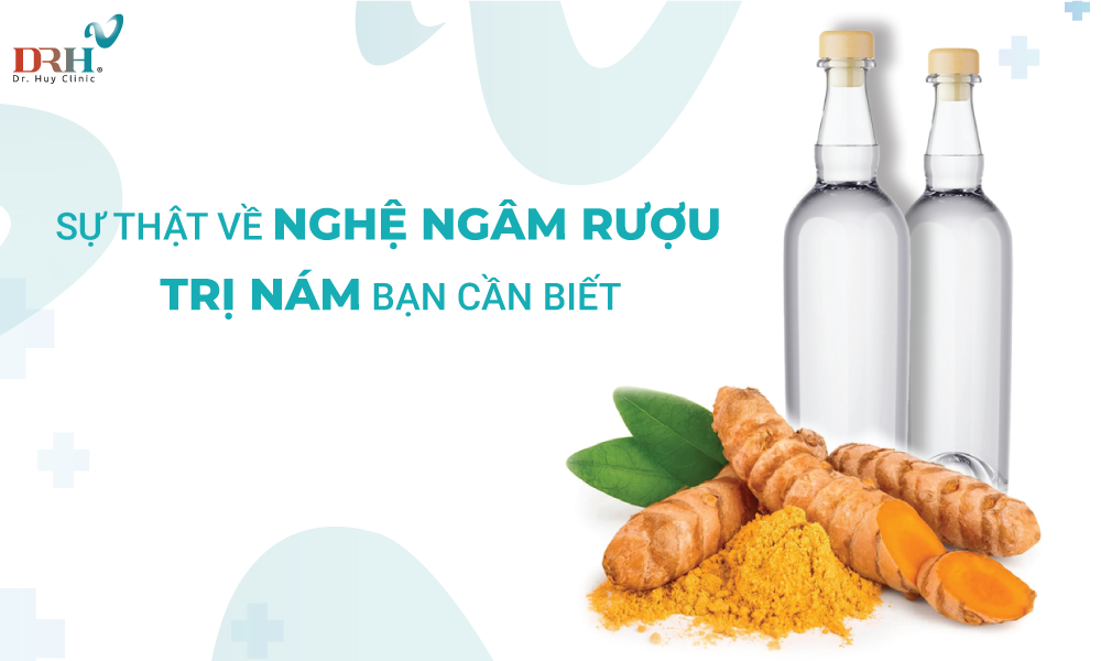 su-that-ve-nghe-ngam-ruou-tri-nam