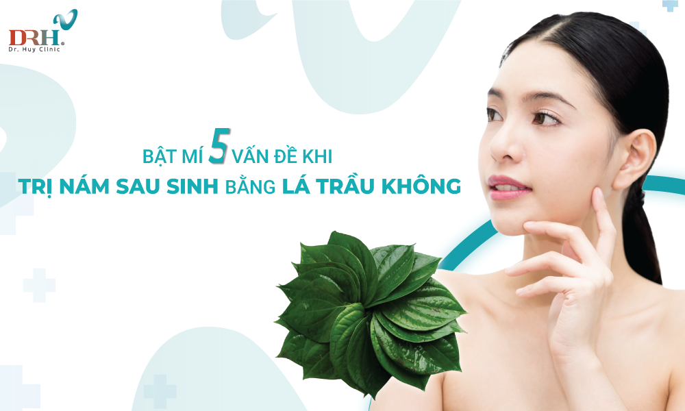 cach-tri-nam-sau-sinh-bang-la-trau-khong