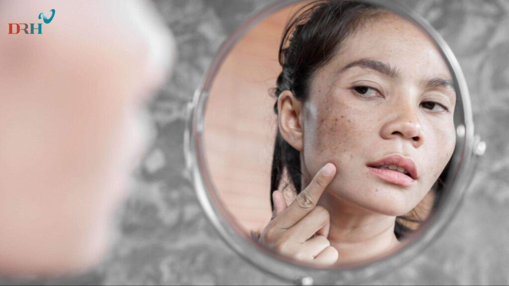 nam-da-sau-sinh-hinh-thanh-do-roi-loan-noi-tiet-to