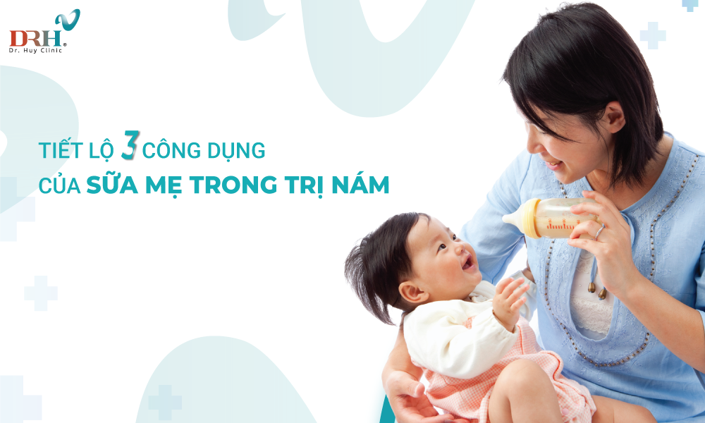 tri-nam-sau-sinh-bang-sua-me