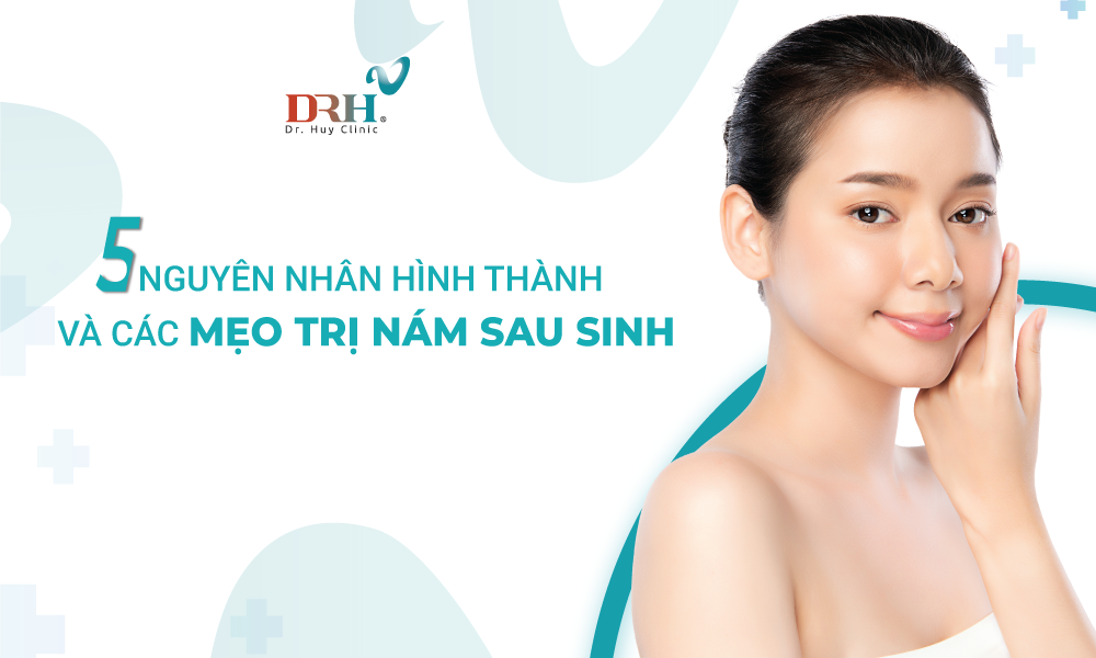 tri-nam-sau-sinh