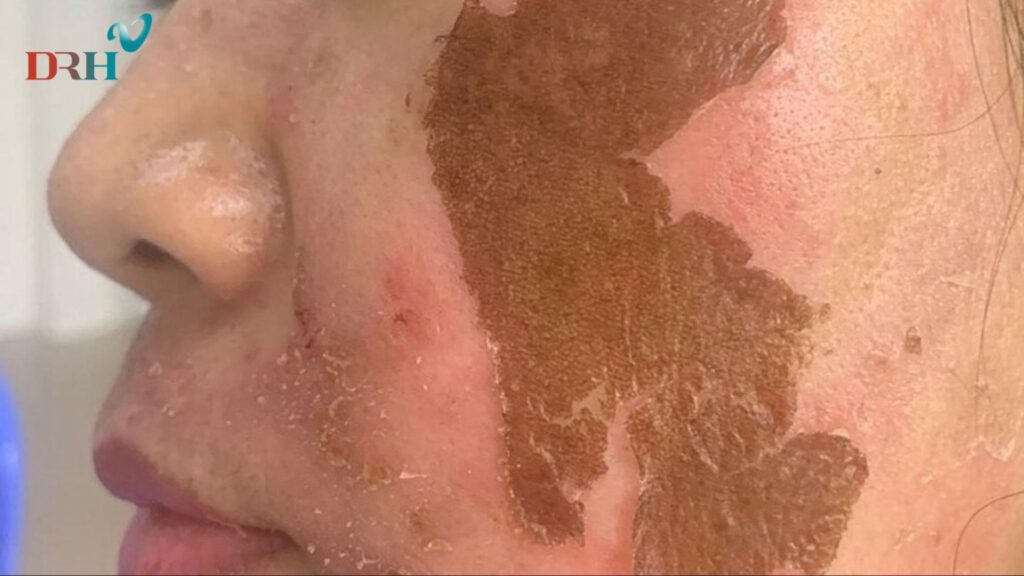 da-bong-troc-do-dung-cong-nghe-kem-chat-luong