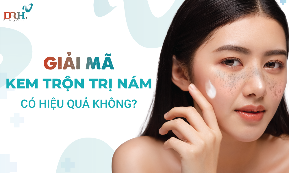 Giải mã thắc mắc kem trộn trị nám có hiệu quả không? - DRH Clinic