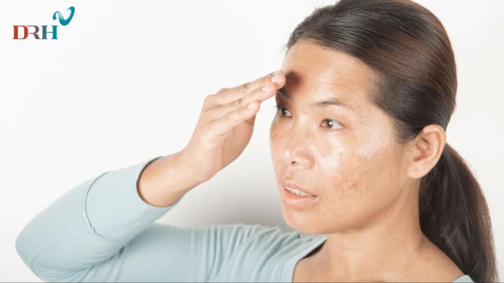 nam-da-sau-sinh-hinh-thanh-do-roi-loan-noi-tiet-to