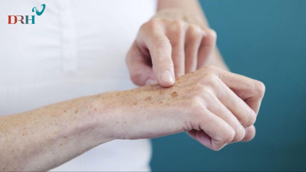 nam-da-tay-hinh-thanh-do-tang-sinh-qua-muc-melanin