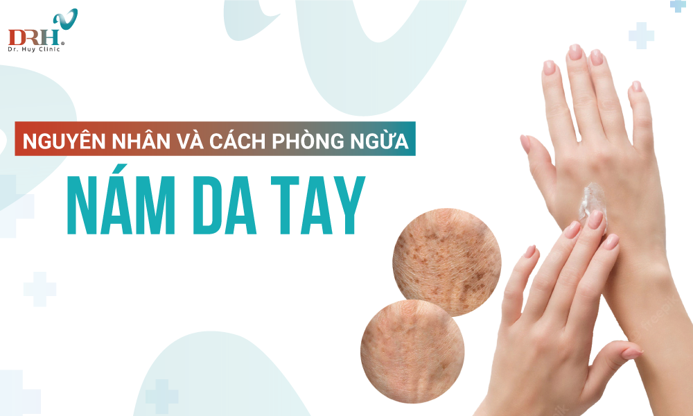 nam-da-tay-nguyen-nhan