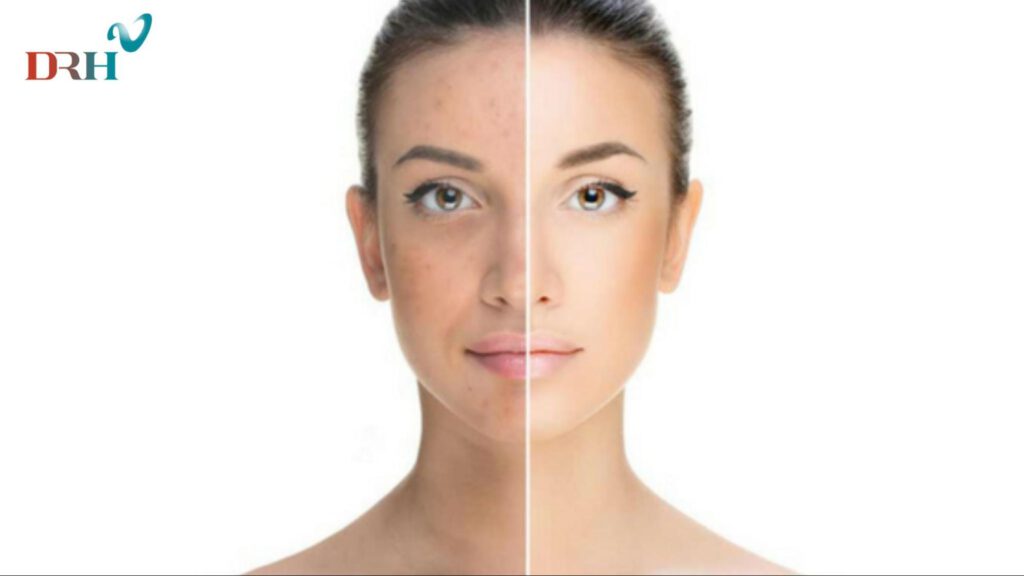 sam-da-hinh-thanh-do-tang-sinh-qua-muc-hac-sac-to