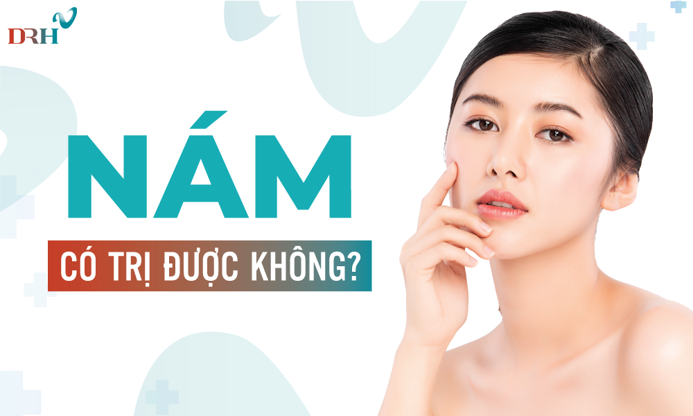 Bác sĩ giải đáp: nám có trị được không? - DRH Clinic