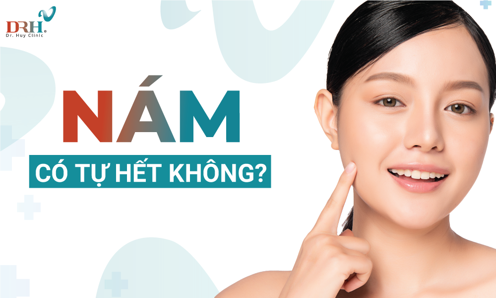 Nám có tự hết không? Đâu mới là phương pháp trị nám phù hợp? - DRH Clinic