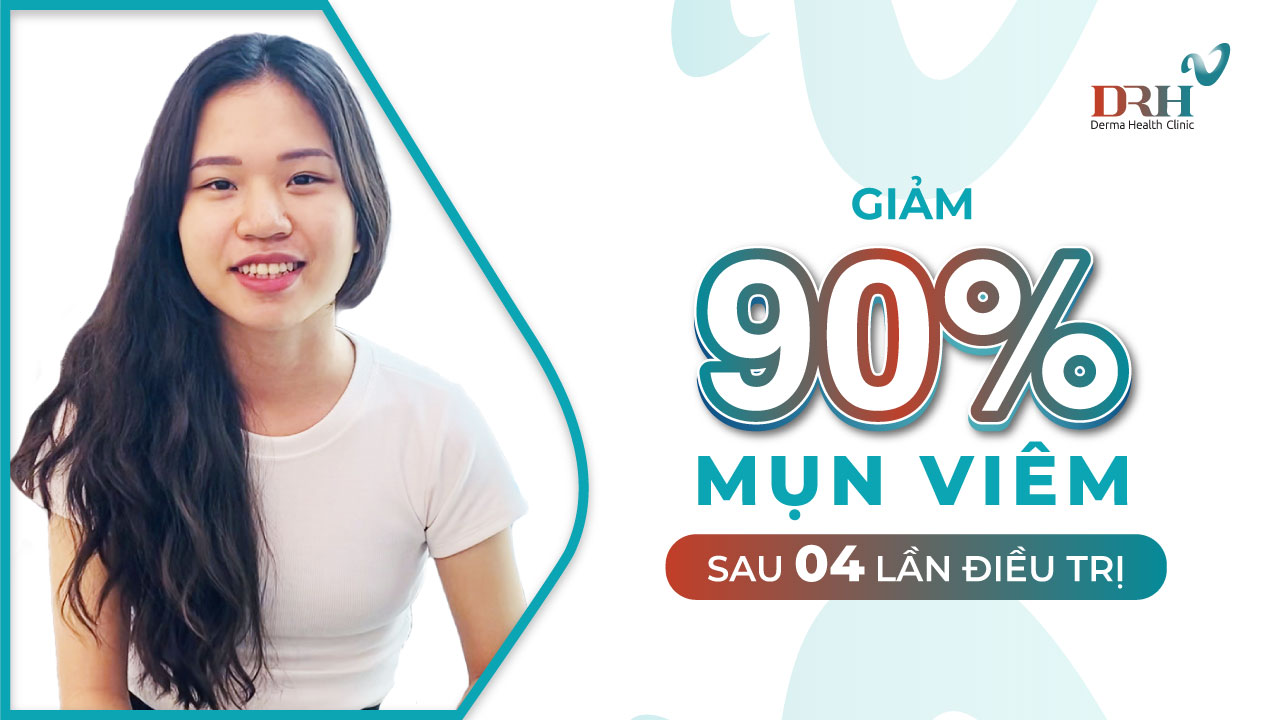 Cam-nhan-khach-hang-mun-drh-clinic