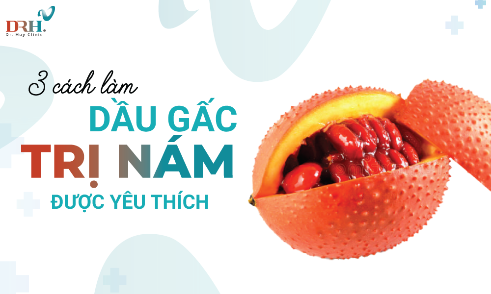 cach-lam-dau-gac-tri-nam