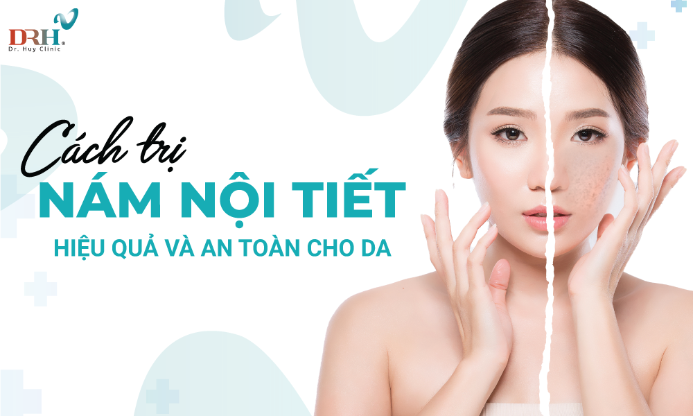 cach-tri-nam-noi-tiet