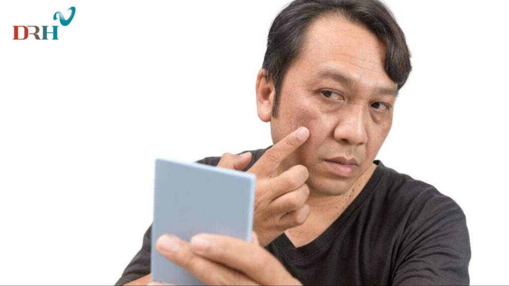 dan-ong-bi-nam-da-mat-1