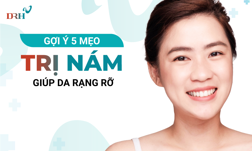 meo-tri-nam