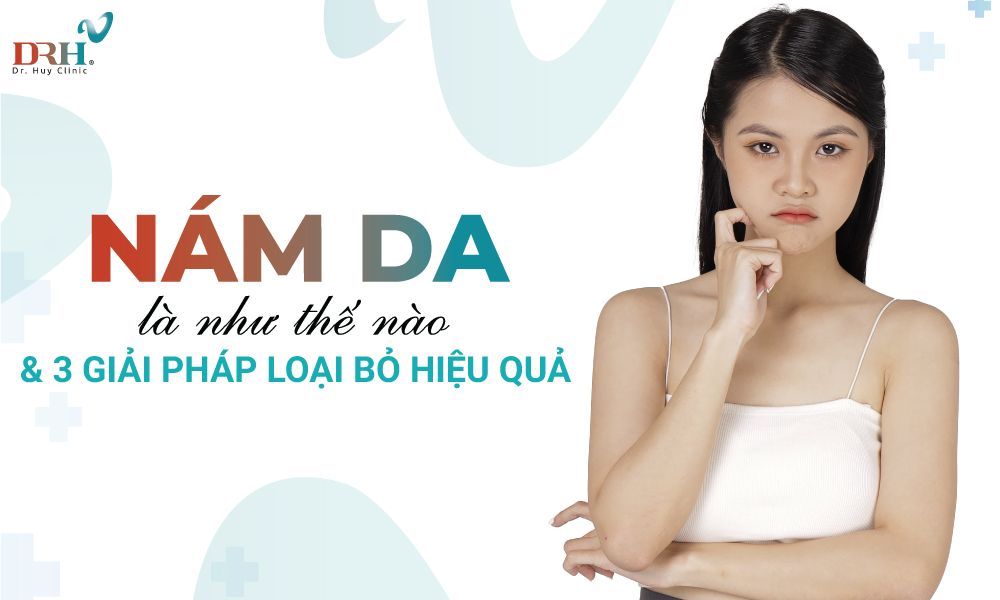nam-da-la-nhu-the-nao