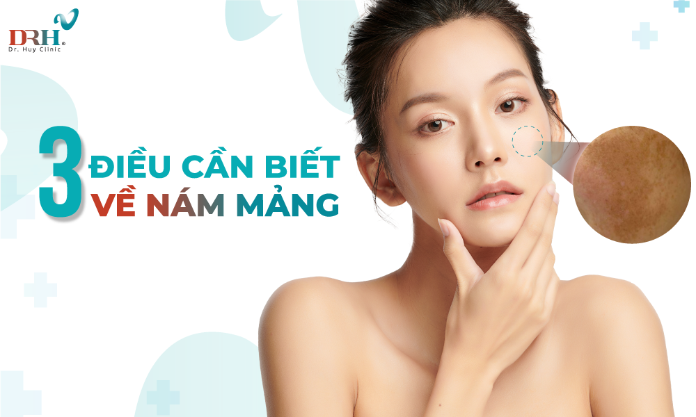 nam-mang-va-cac-dieu-tri