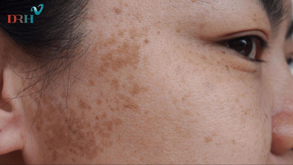 nam-noi-tiet-hinh-thanh-do-su-mat-can-bang-hormone