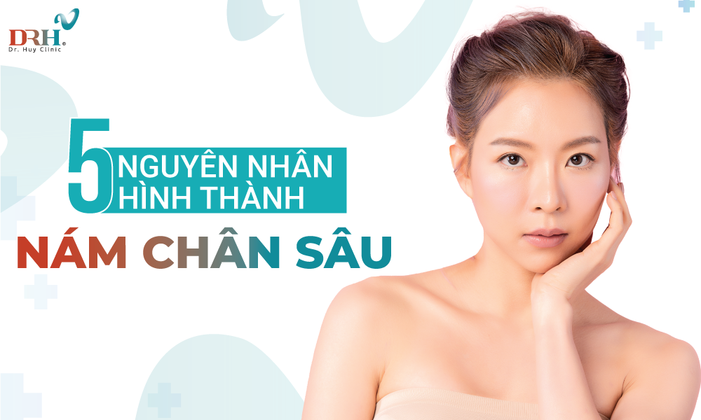 nguyen-nhan-hinh-thanh-nam-chan-sau