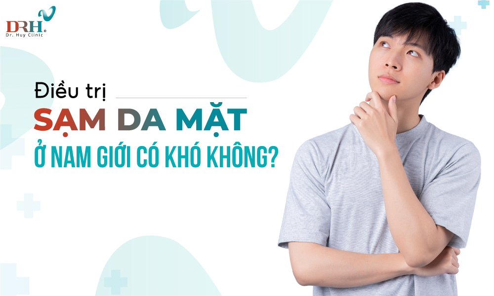 sam-da-mat-o-nam-gioi