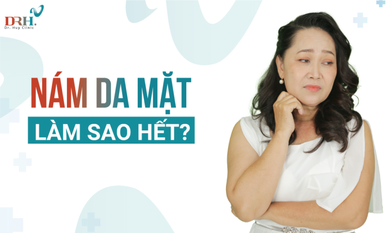 Kinh Nghiệm Trị Nám Da Mặt Làm Sao Hết Tại Nhà Hiệu Quả - DRH Clinic