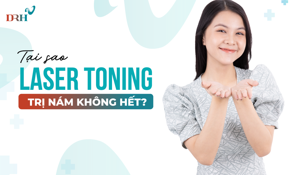 Tri-nam-bang-laser-toning-khong-khoi