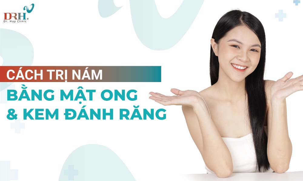 cach-tri-nam-bang-mat-ong-va-kem-danh-rang