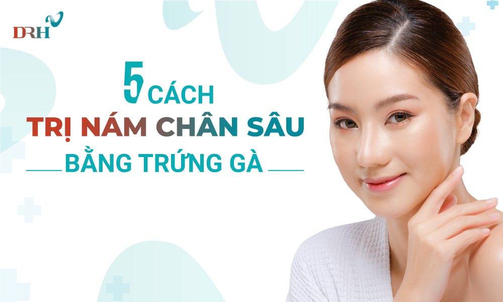 cach-tri-nam-chan-sau-tai-nha