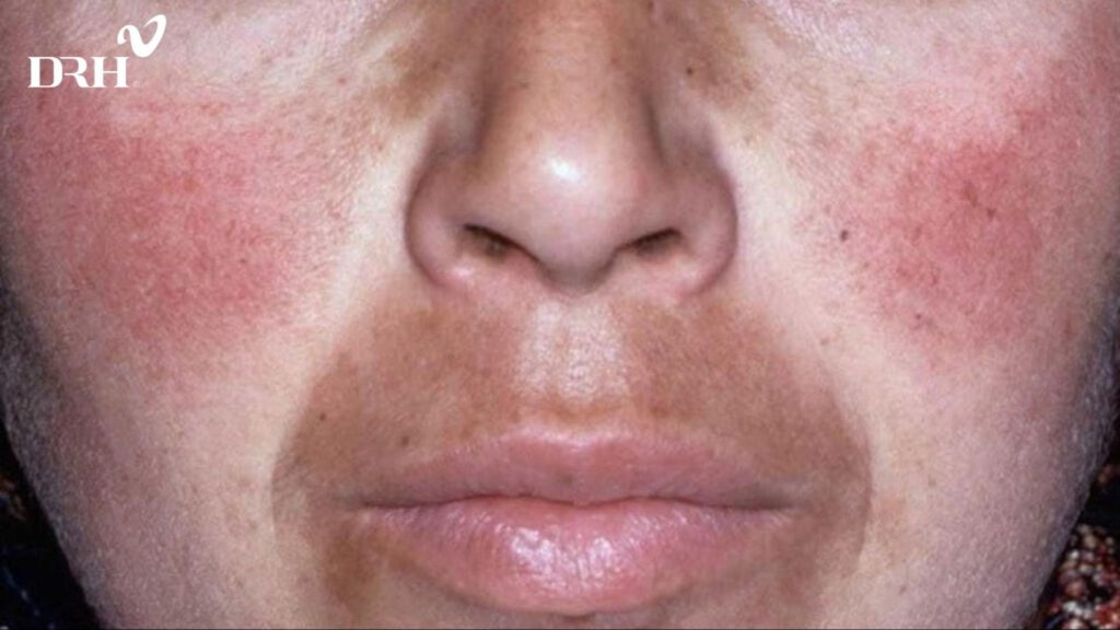 cong-nghe-laser-toning-2