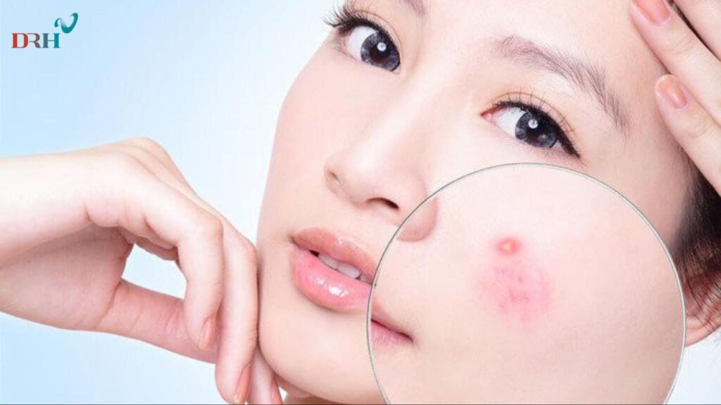 la-lot-co-kha-nang-khang-khuan-giup-ngua-mun