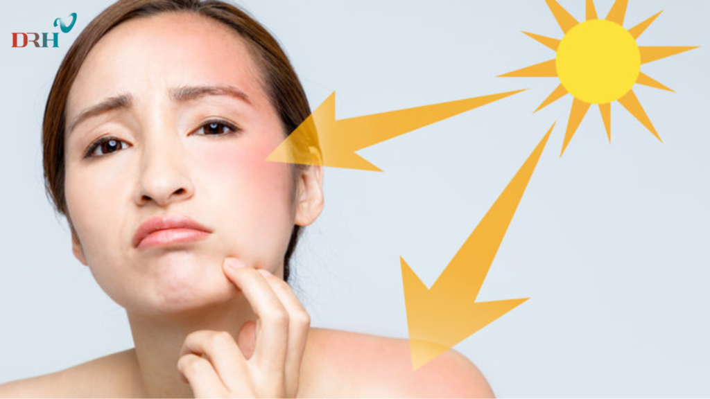 luon-bao-ve-da-bang-kem-chong-nang