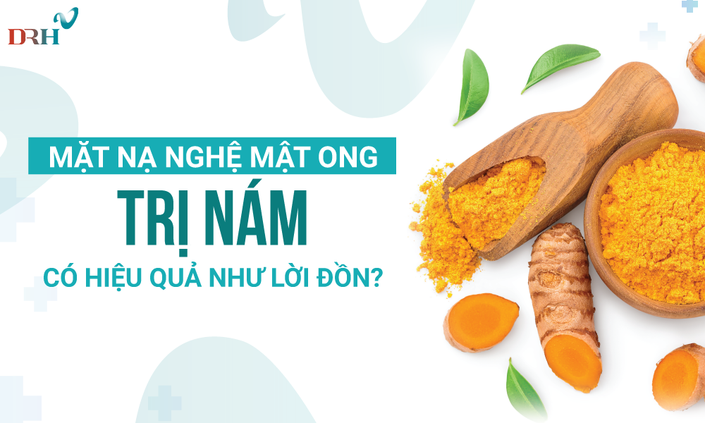 mat-na-nghe-mat-ong-tri-nam