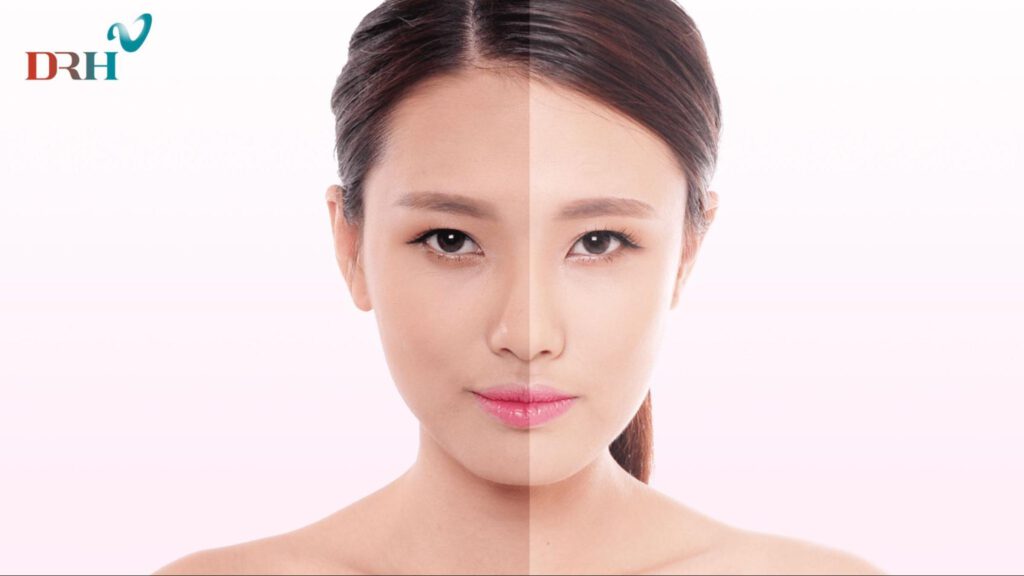 sam-da-sau-sinh-la-cac-mang-da-toi-mau-hon-nen-goc