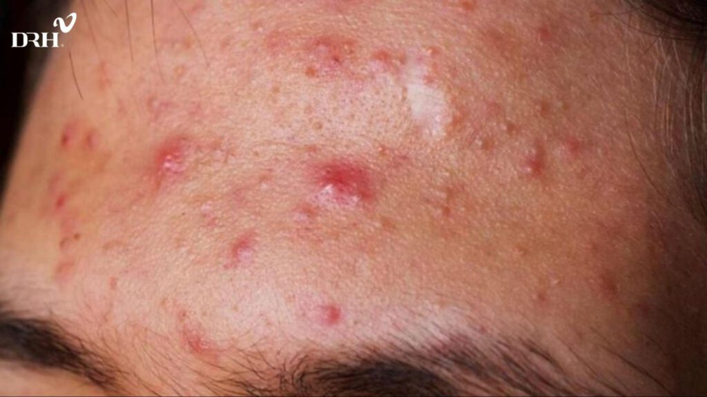 su-dung-la-lot-sai-cach-rat-de-dan-den-kich-ung-da