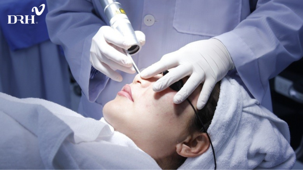 tri-nam-bang-laser-co-tot-khong-1