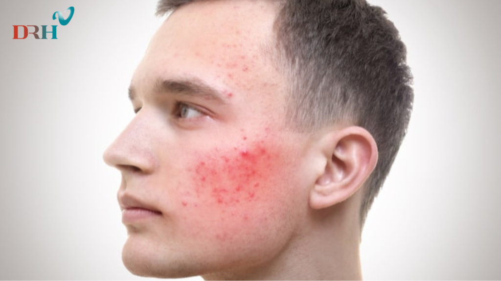 tri-nam-bang-laser-co-tot-khong-2