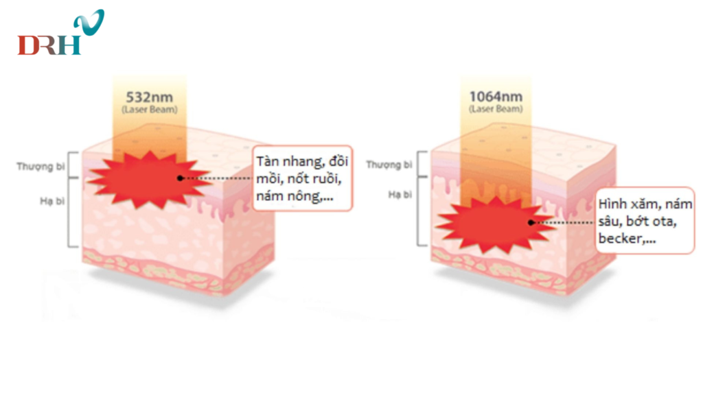 tri-nam-chan-sau-bang-laser-2