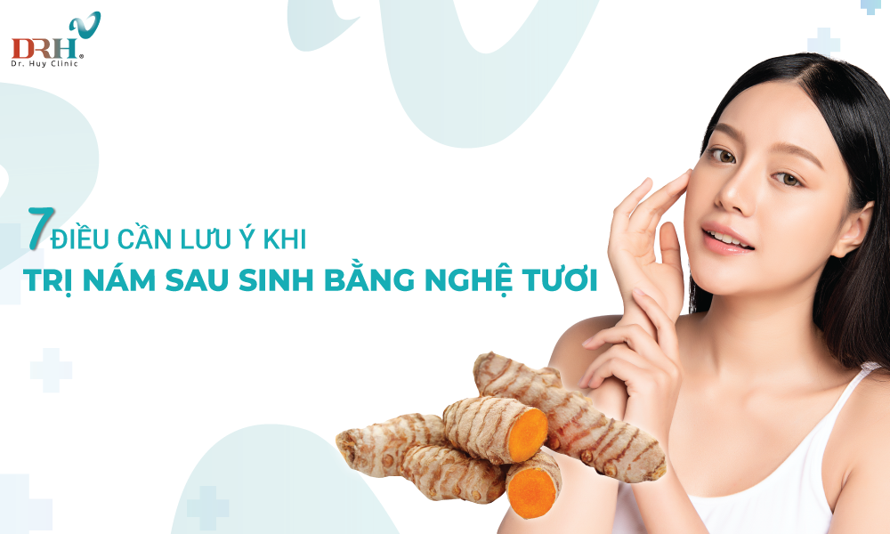 tri-nam-sau-sinh-bang-nghe-tuoi