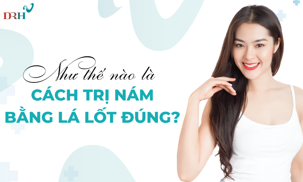 Cach-tri-nam-bang-la-lot