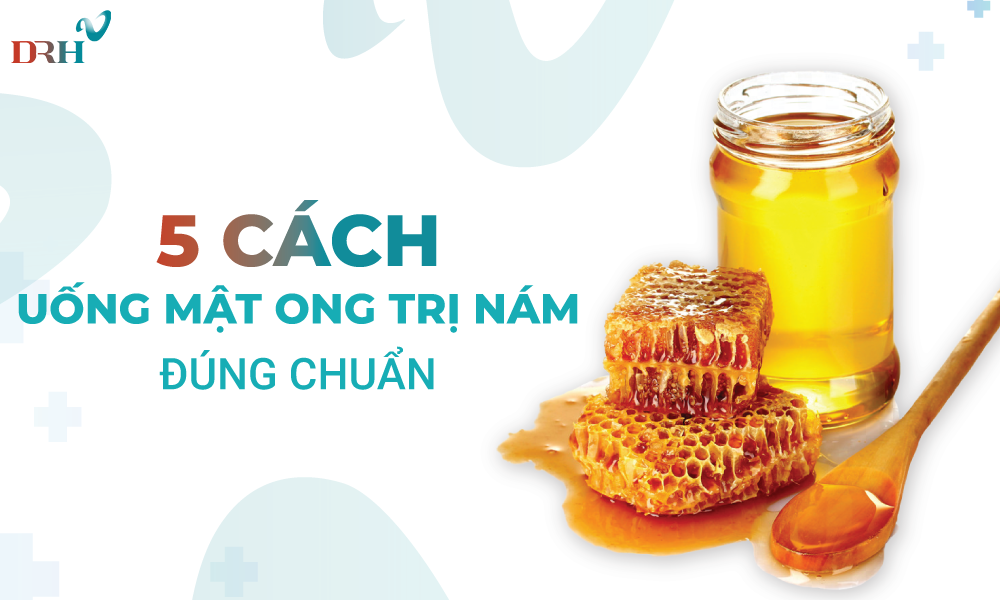 cach-tri-nam-bang-mat-ong