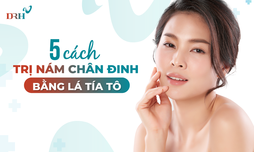 cach-tri-nam-chan-dinh-tai-nha