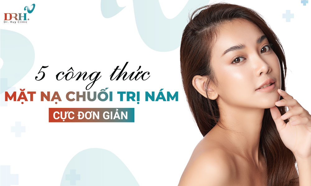 mat-na-chuoi-tri-nam