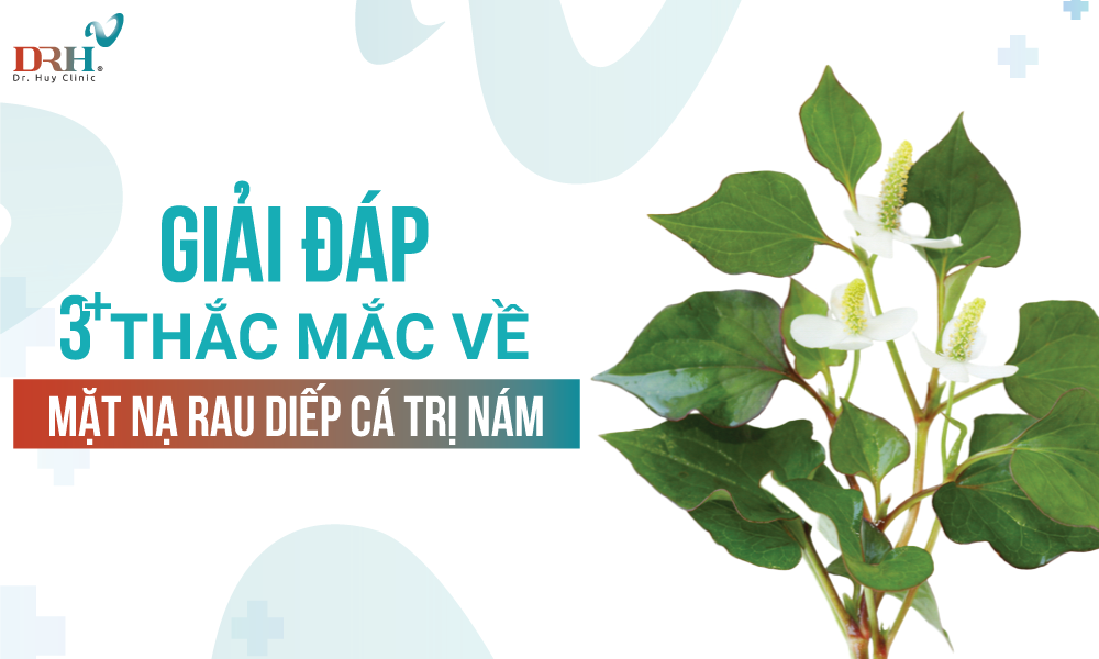 mat-na-diep-ca-tri-nam