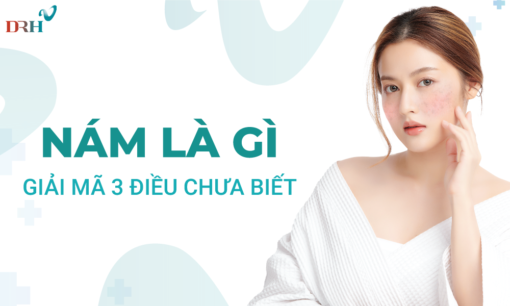 Nám là gì - giải mã 3 điều chưa biết - DRH Clinic