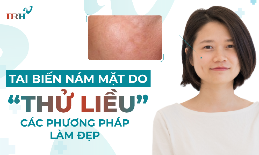 nam-mat