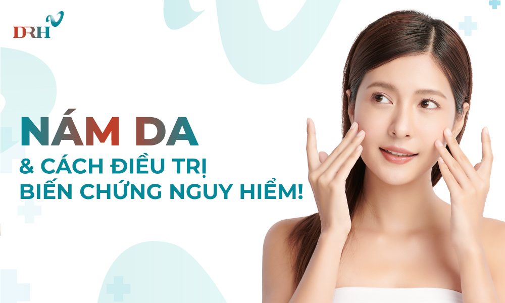 Nám da và cách điều trị biến chứng nguy hiểm! - DRH Clinic